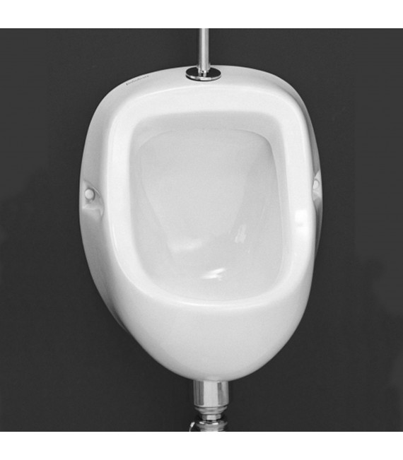 VALADARES URINARIO FACE CON ALIMENTACIÓN SUPERIOR